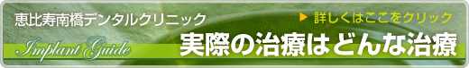 実際の治療はどんな治療